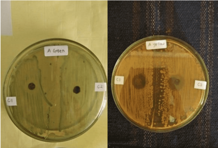 Hình 3. So sánh vòng vô khuẩn của dịch chiết ciplukan với dung môi Chloroform trên khuẩn lạc Vibrio màu xanh lá cây (A) và màu vàng (B).